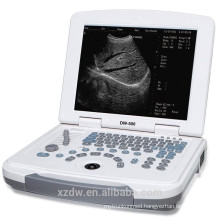 DW-500 laptop ultrasound scanner & ultrasound machine with battery